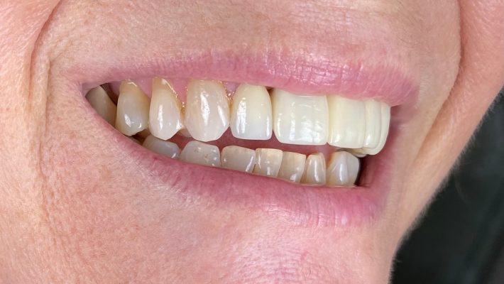Roy Dental